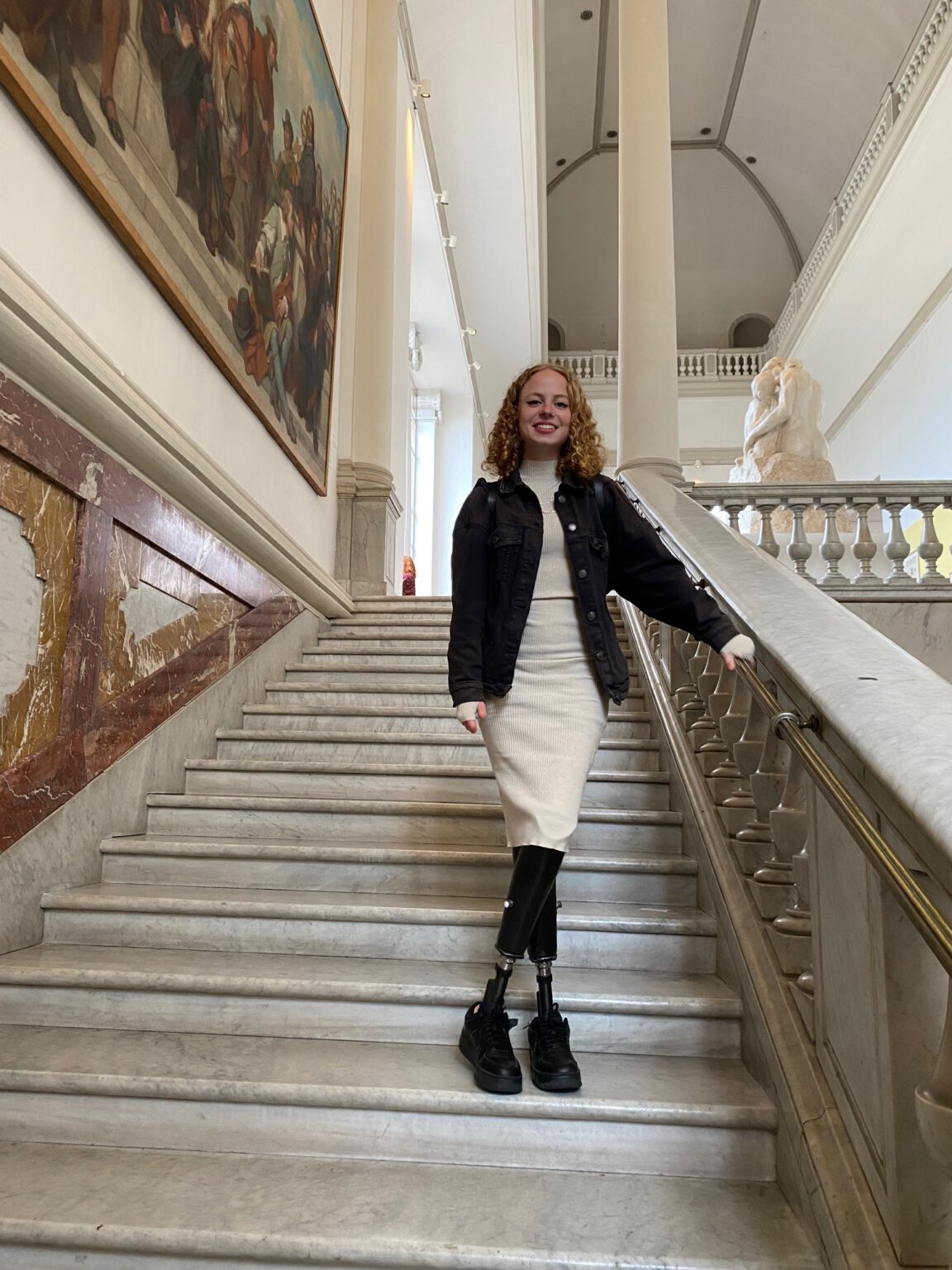 Ein Gespräch mit Justina über Meningokokken, Prothesen und ihre